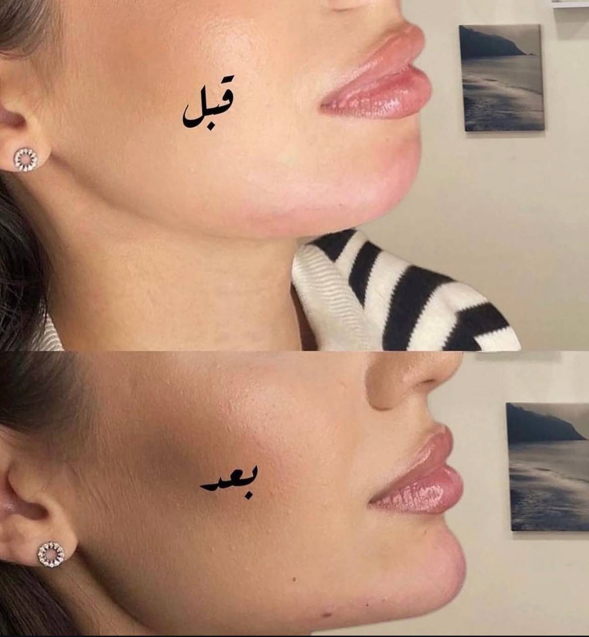 کلینیک زیبایی دنیا مهر در یافت آباد تهران