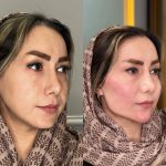 کلینیک زیبایی دنیا مهر در یافت آباد تهران