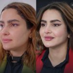 کلینیک زیبایی دنیا مهر در یافت آباد تهران