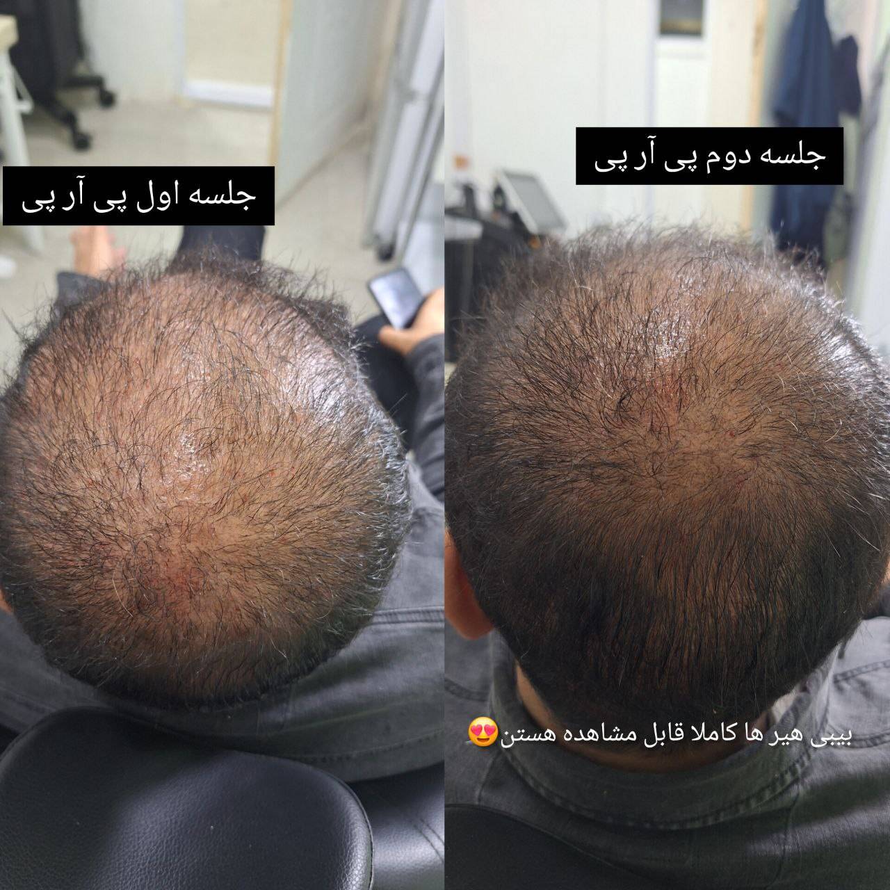 مشاهده کلینیک تخصصی پوست و مو دکتر نیما خسروی در کرمانشاه در سامانه بهبود مشاغل