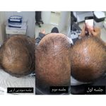 کلینیک تخصصی پوست و مو دکتر نیما خسروی در کرمانشاه