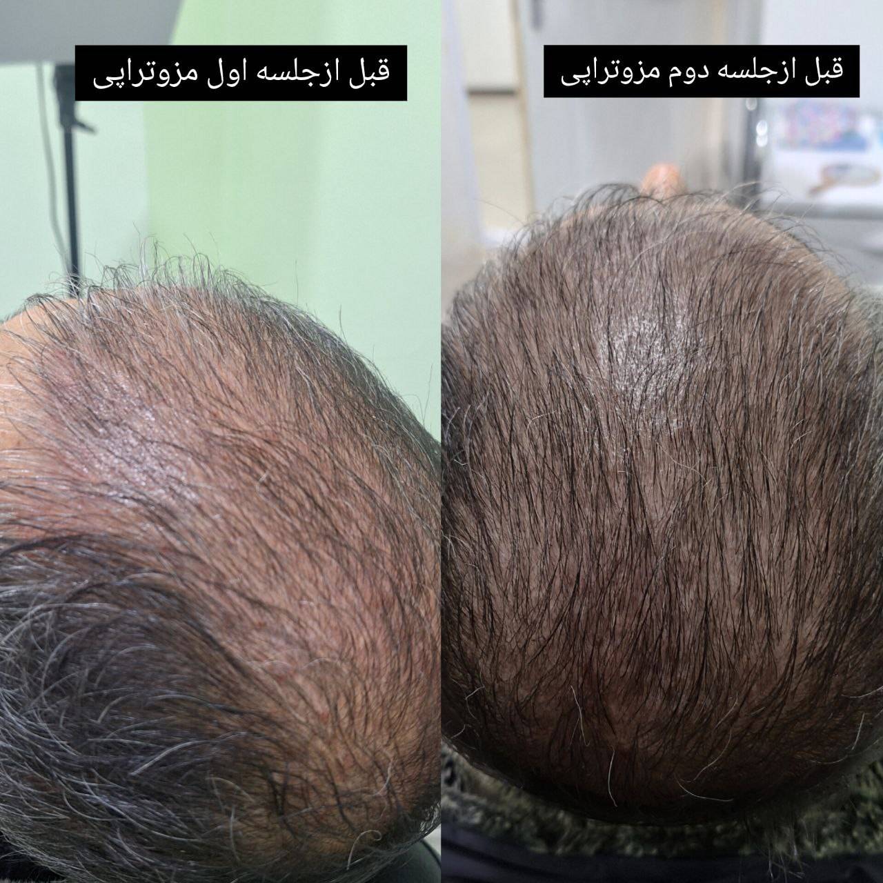 مشاهده کلینیک تخصصی پوست و مو دکتر نیما خسروی در کرمانشاه در سامانه بهبود مشاغل
