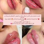 کلینیک زیبایی نورا در محمدشهر