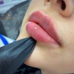 کلینیک زیبایی نورا در محمدشهر