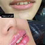 کلینیک زیبایی آیدا در مشهد