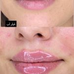 کلینیک زیبایی آیدا در مشهد