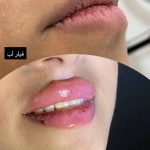 کلینیک زیبایی آیدا در مشهد