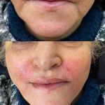 کلینیک زیبایی آیدا در مشهد