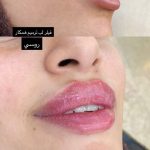 کلینیک زیبایی آیدا در مشهد