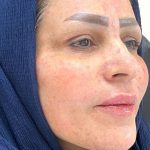 کلینیک زیبایی آیدا در مشهد