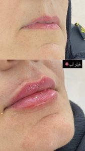 مشاهده کلینیک زیبایی آیدا در مشهد در سامانه بهبود مشاغل