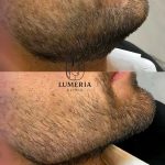 کلینیک زیبایی لومریا در ارومیه