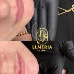 کلینیک زیبایی لومریا در ارومیه