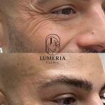 کلینیک زیبایی لومریا در ارومیه