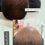 کلینیک تخصصی پوست و مو دکتر نیما خسروی در کرمانشاه
