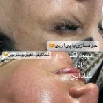 کلینیک تخصصی پوست و مو دکتر نیما خسروی در کرمانشاه