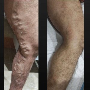 مشاهده آگهی مرکز تخصصی درمان واریس دکتر مهرنوش بختیاری در دورود در سامانه بهبود مشاغل