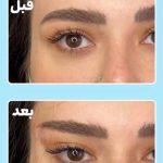 کلینیک زیبایی نونا در گرگان