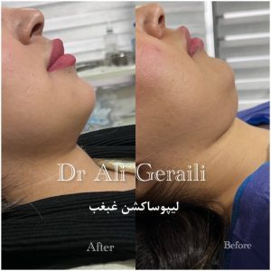 مشاهده کلینیک زیبایی نونا در گرگان در سامانه بهبود مشاغل
