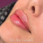 کلینیک زیبایی نونا در گرگان