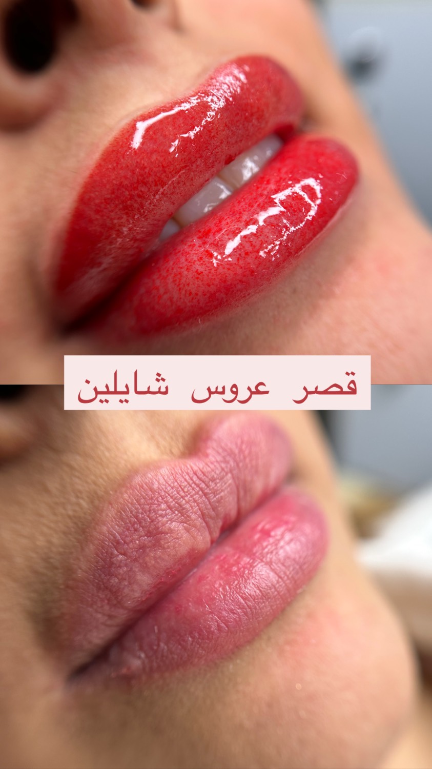 مشاهده آگهی سالن زیبایی شایلین در بلوار ابوذر تهران در سامانه بهبود مشاغل