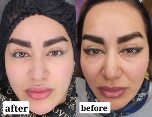 مرکز تخصصی میکروبلیدینگ و ریموو ابرو زینب رحیم پور در زنجان