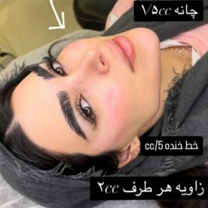مشاهده آگهی کلینیک زیبایی پوست رایان در قزوین در سامانه بهبود مشاغل