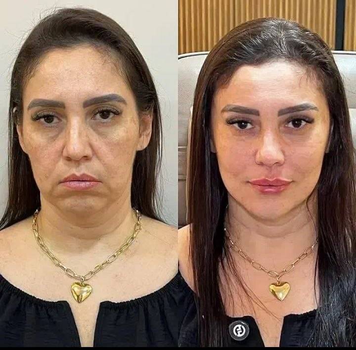 مشاهده آگهی کلینیک زیبایی پوست رایان در قزوین در سامانه بهبود مشاغل