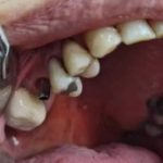 مرکز تخصصی ایمپلنت آسیا در ایلام