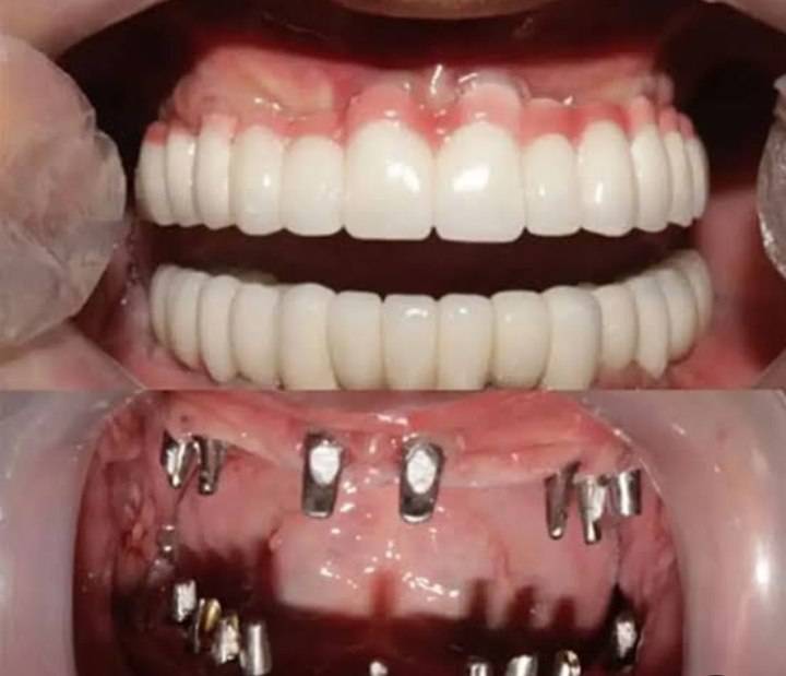 مشاهده آگهی مرکز تخصصی ایمپلنت آسیا در ایلام در سامانه بهبود مشاغل