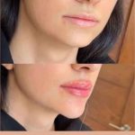 کلینیک تخصصی زیبایی لیزرلند در ارومیه