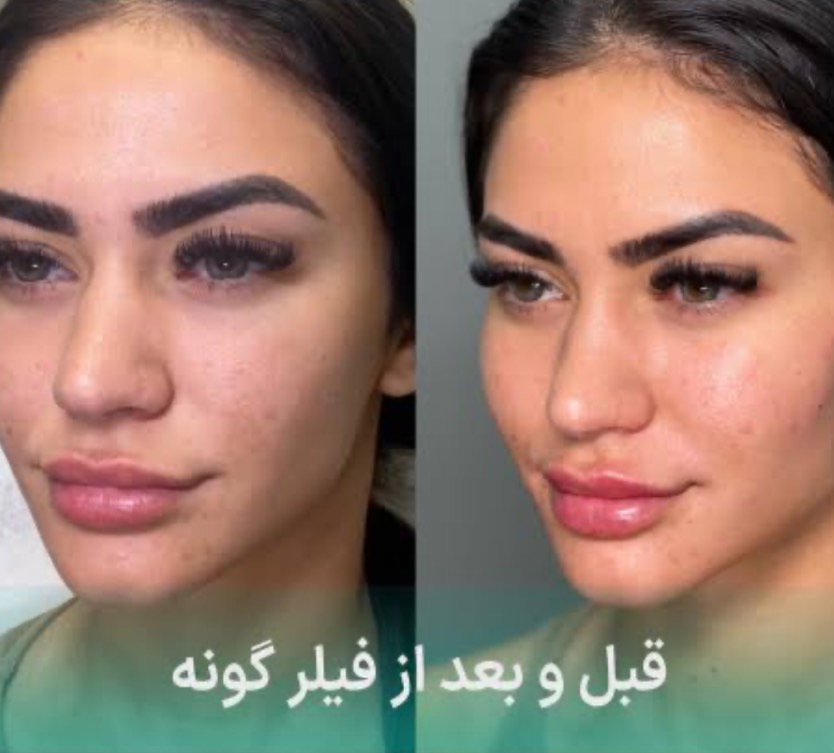 مشاهده آگهی کلینیک تخصصی زیبایی لیزرلند در ارومیه در سامانه بهبود مشاغل