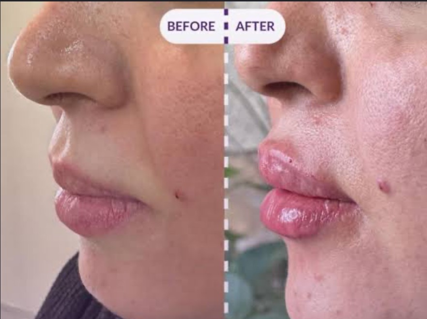 مشاهده آگهی کلینیک تخصصی زیبایی لیزرلند در ارومیه در سامانه بهبود مشاغل