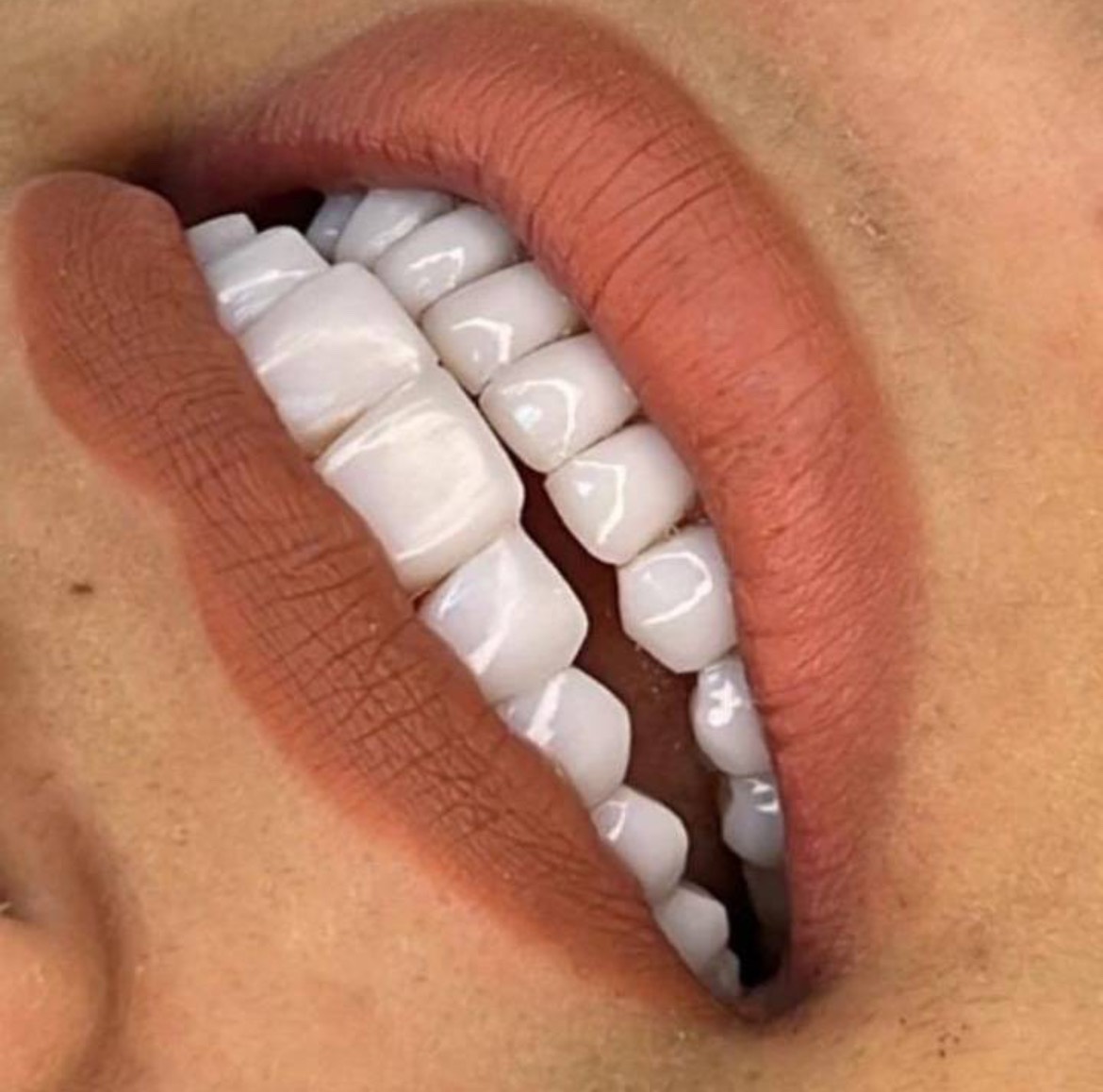 مشاهده آگهی مطب دندانپزشکی دکتر بهروز افراشته در رشت در سامانه بهبود مشاغل