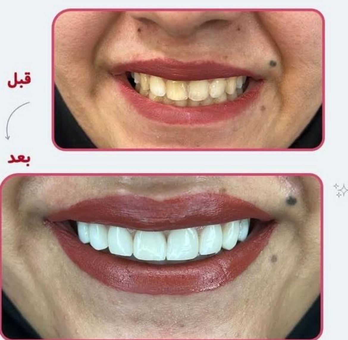 مشاهده آگهی مطب دندانپزشکی دکتر بهروز افراشته در رشت در سامانه بهبود مشاغل