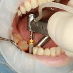 مطب دندانپزشکی دکتر بهروز افراشته در رشت