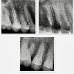 مطب دندانپزشکی دکتر بهروز افراشته در رشت