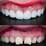 مطب دندانپزشکی دکتر بهروز افراشته در رشت