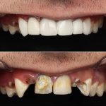 مطب دندانپزشکی دکتر بهروز افراشته در رشت