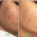 کلینیک زیبایی بولومون در سعادت آباد تهران