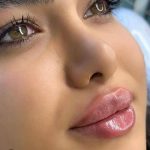 کلینیک زیبایی بولومون در سعادت آباد تهران