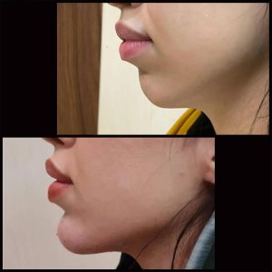 مشاهده کلینیک زیبایی بولومون در سعادت آباد تهران در سامانه بهبود مشاغل