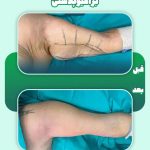 کلینیک زیبایی بولومون در سعادت آباد تهران