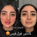 کلینیک زیبایی سوگل در گوهردشت کرج