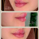 کلینیک زیبایی و لاغری دلارز در شهریار