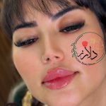 کلینیک زیبایی و لاغری دلارز در شهریار