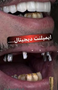 مشاهده کلینیک دندانپزشکی دکتر آذر کاشانی در تجریش تهران در سامانه بهبود مشاغل