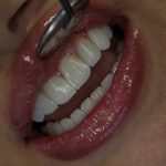 کلینیک دندانپزشکی دکتر آذر کاشانی در تجریش تهران