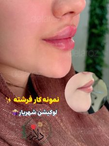 مشاهده کلینیک زیبایی و لاغری دلارز در شهریار در سامانه بهبود مشاغل