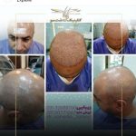 کلینیک تخصصی کاشت مو و ابرو یاسمین در سپاهانشهر اصفهان